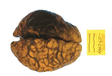 Brain specimen captured with Model 702 system